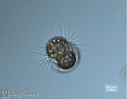 Photo of Mesodinium rubrum